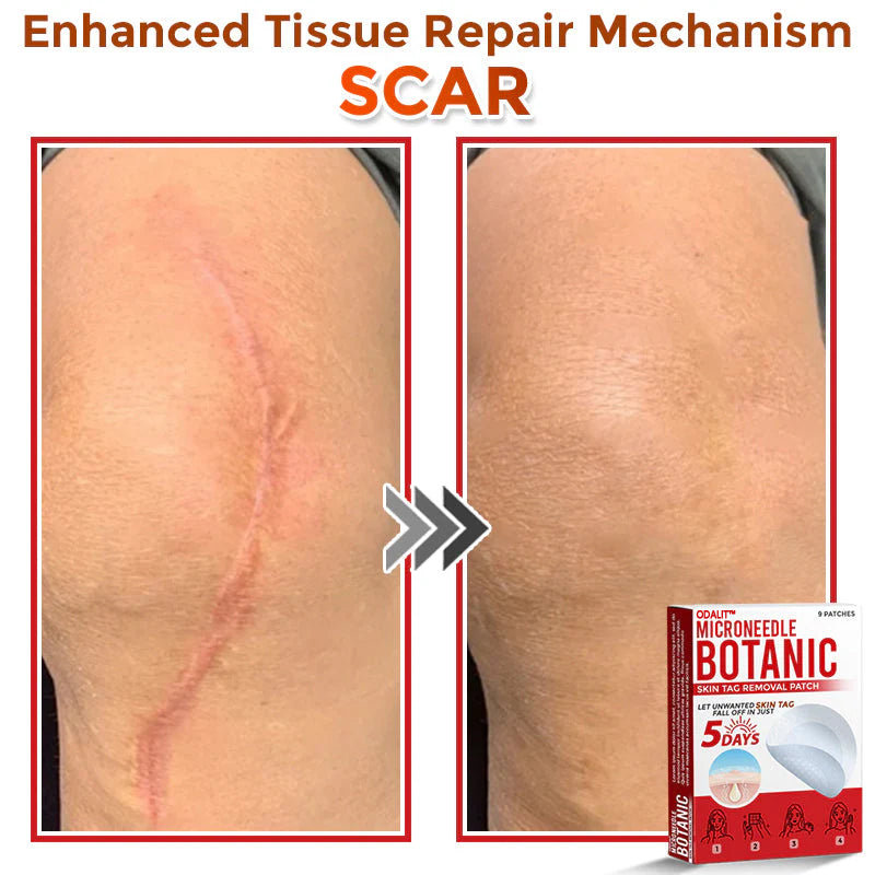 🌈 ODALIT™MicroNeedle Botanic Skin Tag Removal Patch