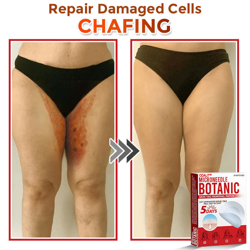 🌈 ODALIT™MicroNeedle Botanic Skin Tag Removal Patch