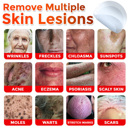 🌈 ODALIT™MicroNeedle Botanic Skin Tag Removal Patch